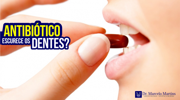 Antibiótico escurece os dentes? Antibiótico escurece os dentes?