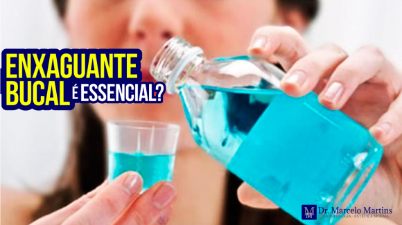 Enxaguante bucal é essencial? Enxaguante bucal é essencial?