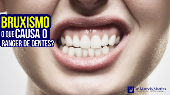 Bruxismo o que causa o ranger de dentes? Bruxismo o que causa o ranger de dentes?