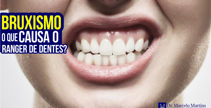 Bruxismo o que causa o ranger de dentes? Bruxismo o que causa o ranger de dentes?